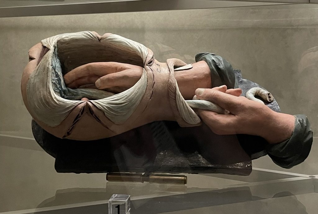 anatomical wax, poggi palace, bologna