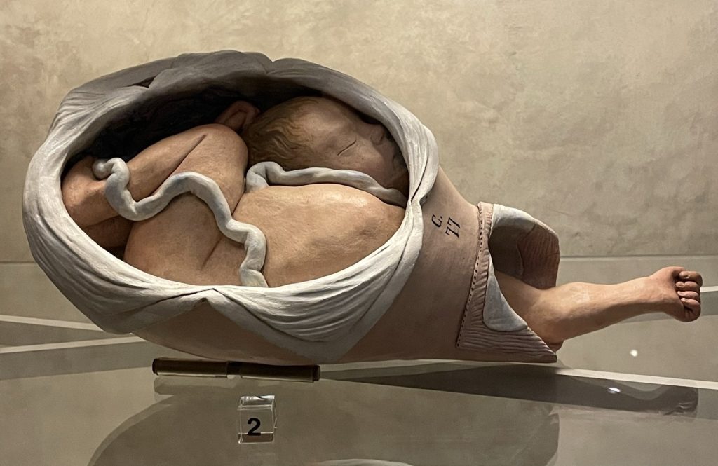 anatomical wax, poggi palace, bologna